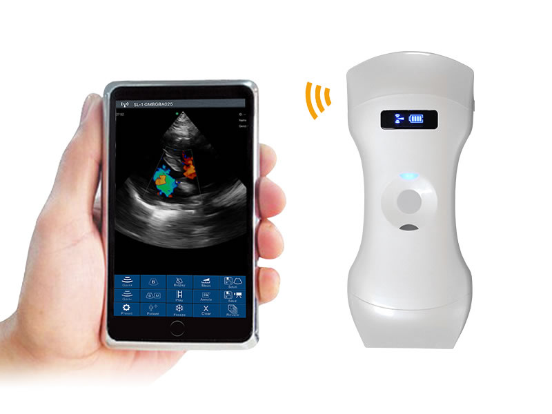 6CPL 3in1 palm doppler ultrasound scanner