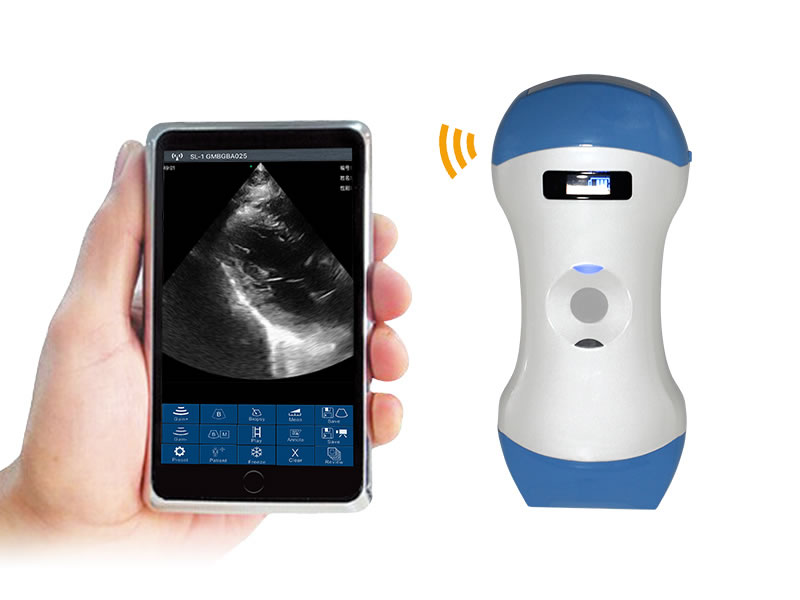 5CPL 3in1 palm doppler ultrasound scanner