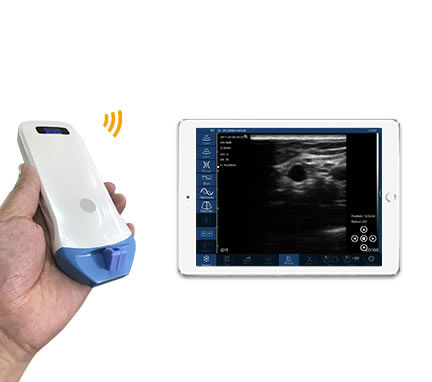 掌上超声在医学健康领域的应用与发展