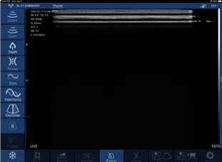 WirelessUSG Android APP