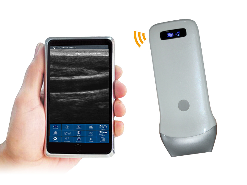 3L linear palm B/W ultrasound scanner