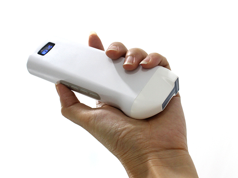 6DL biplane linear palm doppler ultrasound scanner