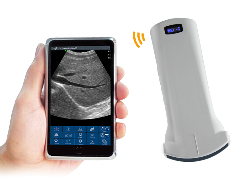 6C convex palm doppler ultrasound scanner