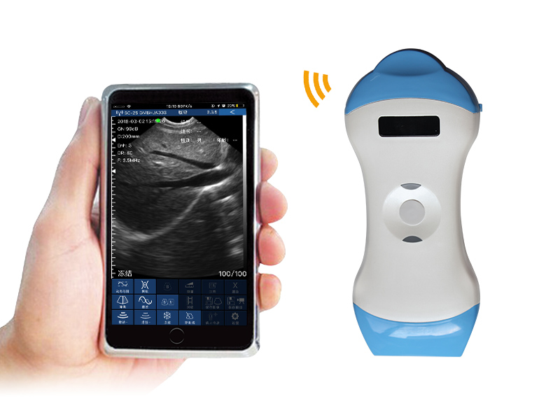 5ML 2in1 palm doppler ultrasound scanner