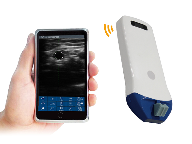 5P UHF linear palm doppler ultrasound scanner