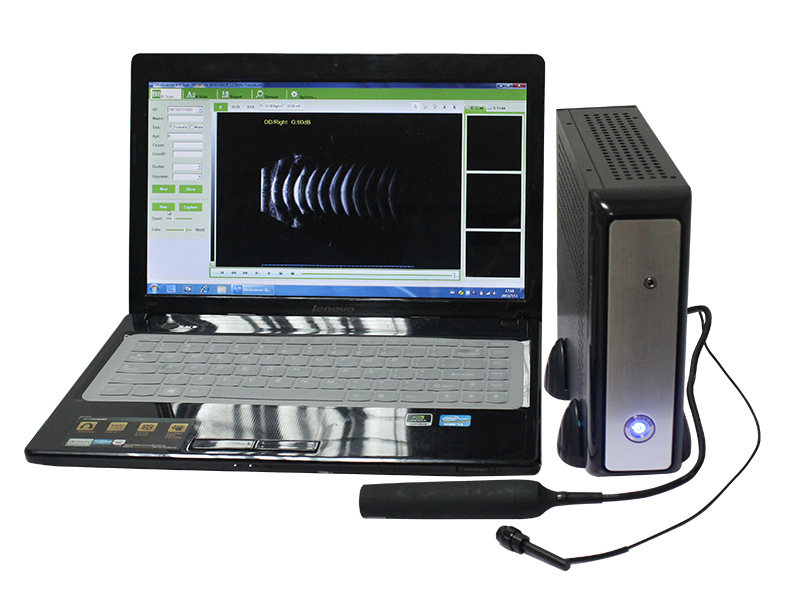 SAB-200 Ophthalmic A/B Scanner