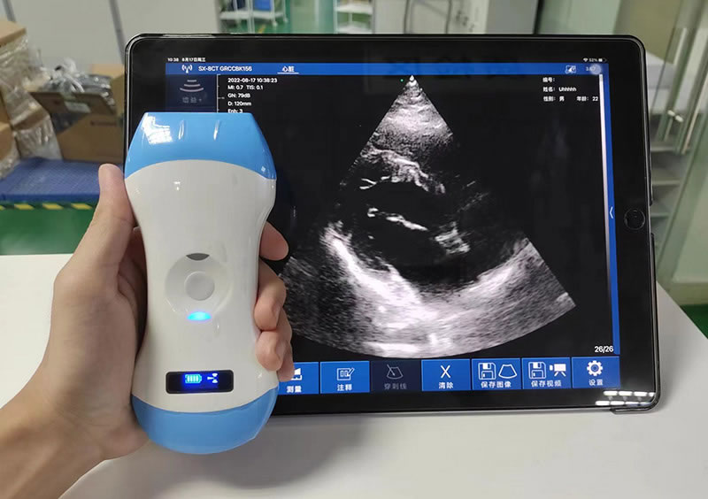 5CPL 3in1 palm doppler ultrasound scanner