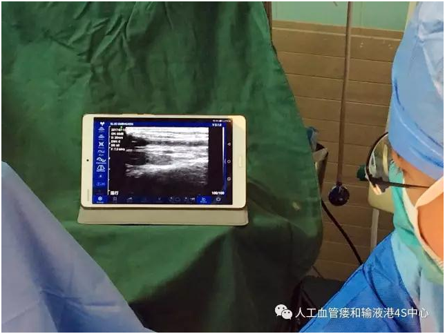 Wireless Guidance Technology continues the Dialysis lifeline with infinite vitality——China's fi