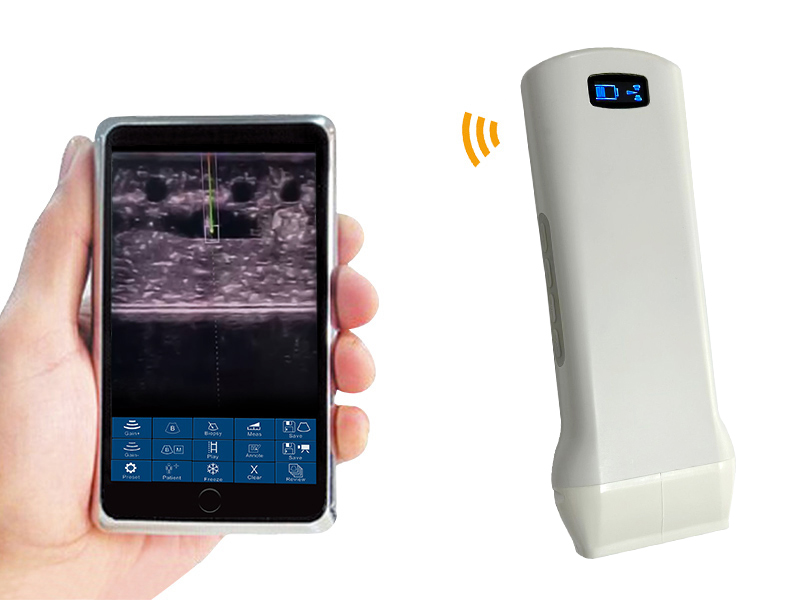 6X Accurate Puncture Linear Handheld Color Wireless Probe Type Ultrasound Scanner