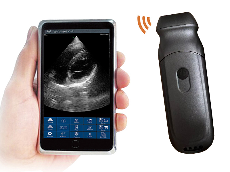 6PA phased array palm doppler ultrasound scanner