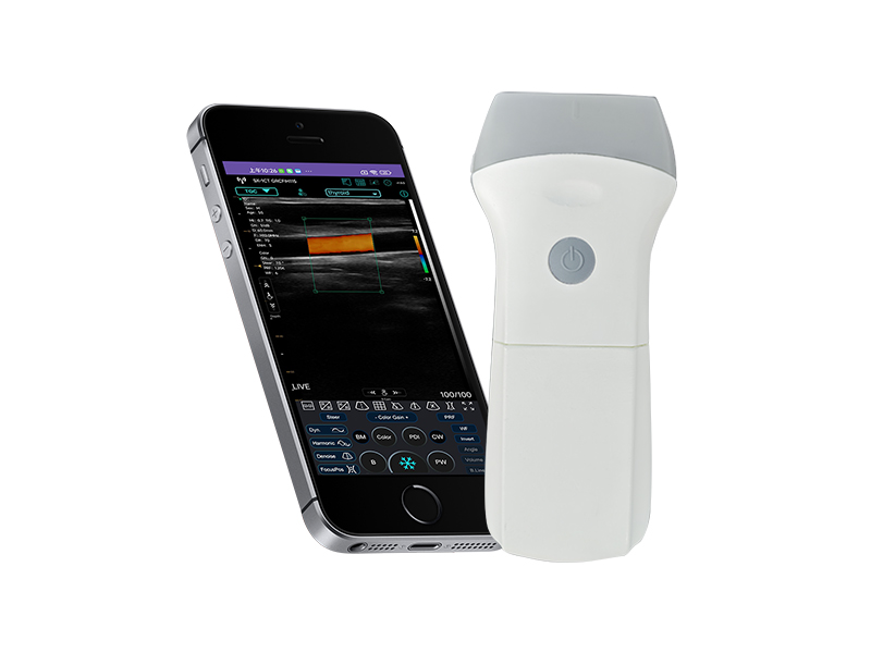 9L Replaceable Battery linear palm doppler ultrasound scanner(VIP Exclusive)