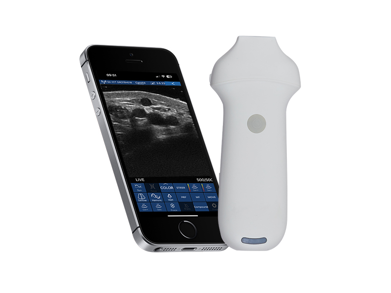 8H linear palm doppler ultrasound scanner