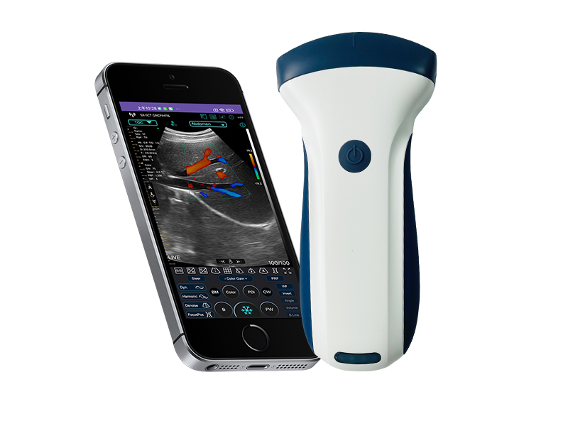 7C convex palm doppler ultrasound scanner