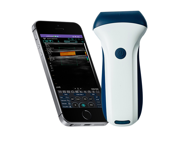 7L linear palm doppler ultrasound scanner