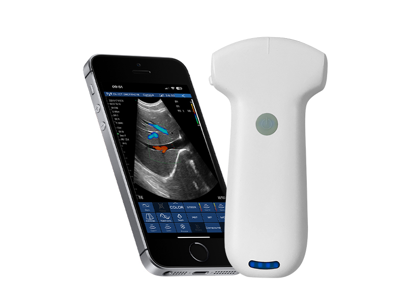 8C convex palm doppler ultrasound scanner