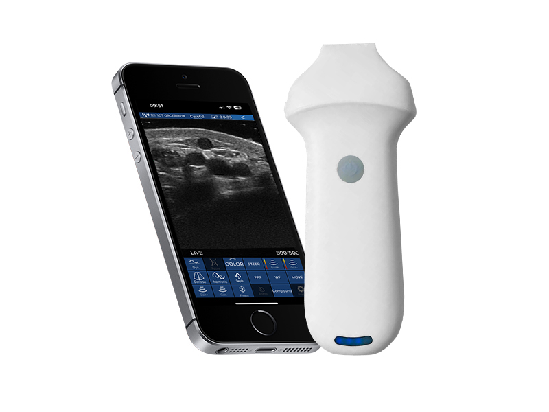 8S linear palm doppler ultrasound scanner