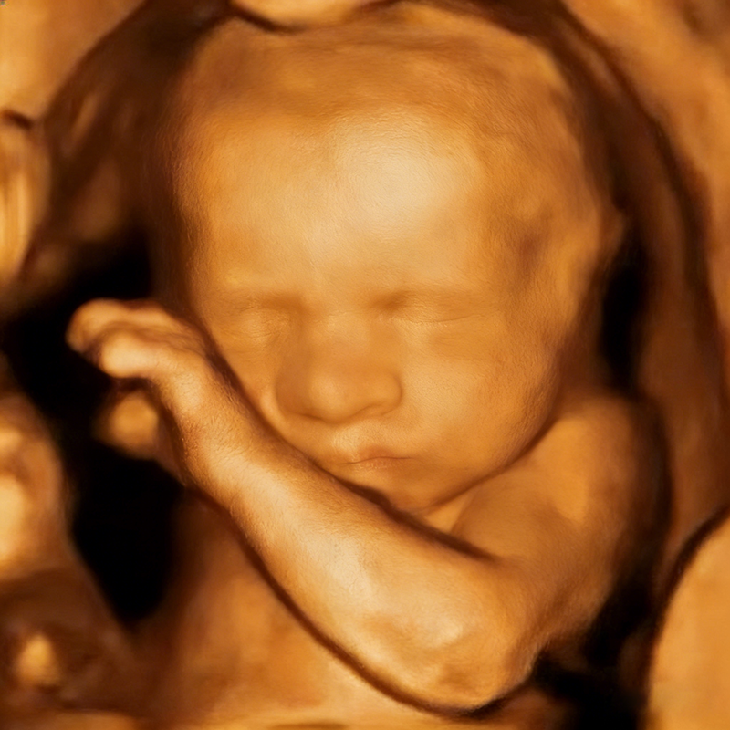 将图片变清晰 (2).png