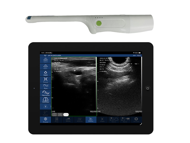 8CR biplane rectal palm doppler ultrasound scanner(VIP Exclusive)