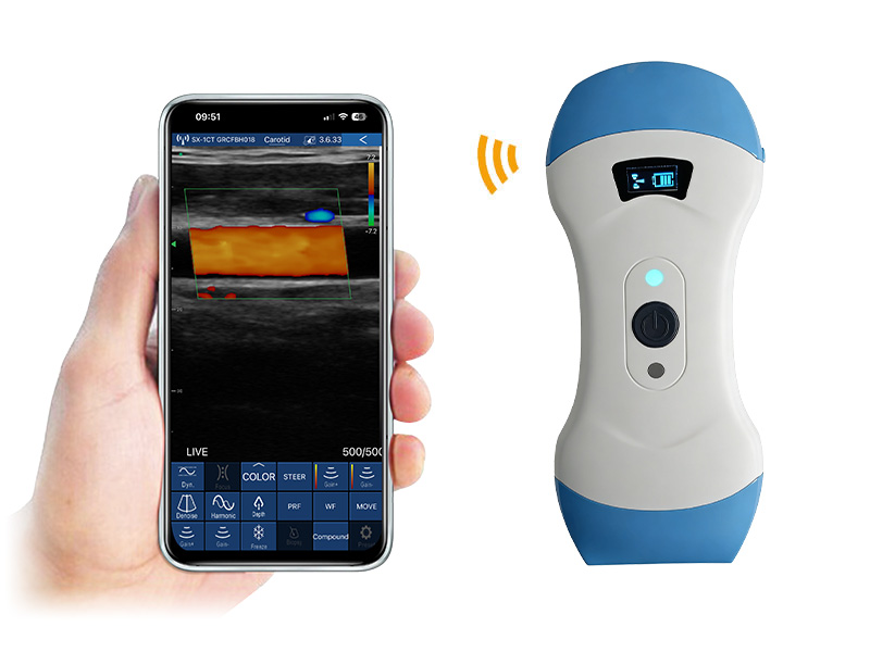 5CPL Plus 3in1 palm doppler ultrasound scanner
