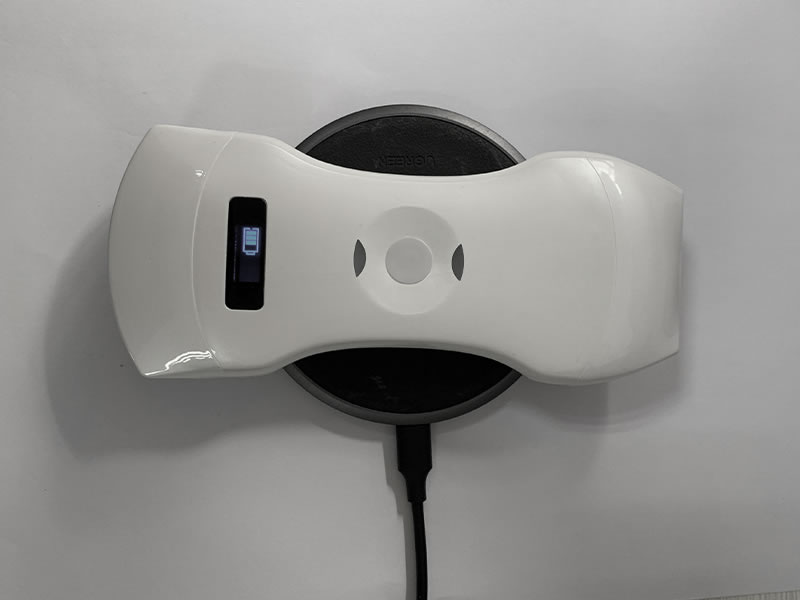 Portable Ultrasound Diagnostic Devices: Practical Values in Mobile Medical Care | Sonostar