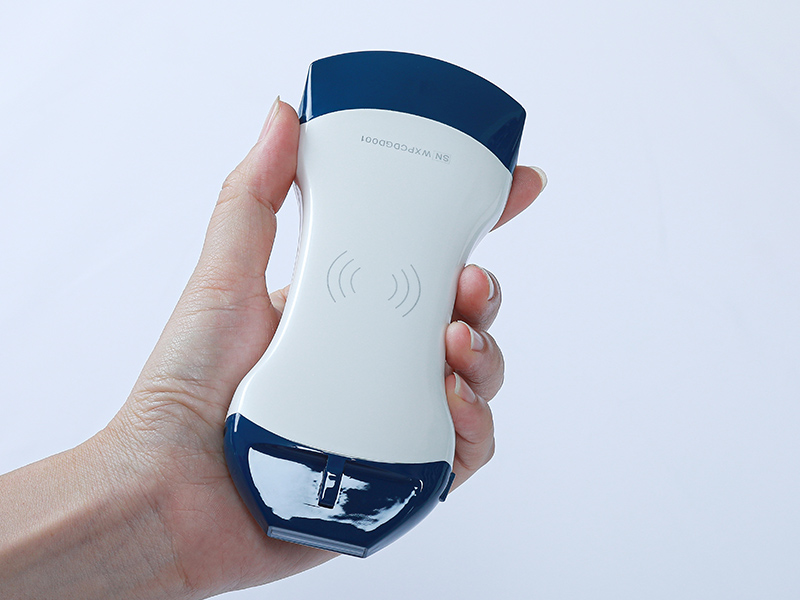 Clinical Procurement Guide for Sonostar Portable Ultrasound Diagnostic Devices Clinical Procurement Guide for Sonostar Portable Ultrasound Diagnostic Devices