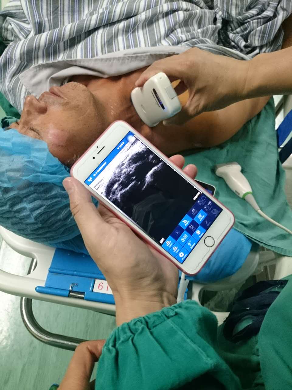 How to Choose a Cost‑Effective Wireless Handheld Ultrasound for Hospital Procurement