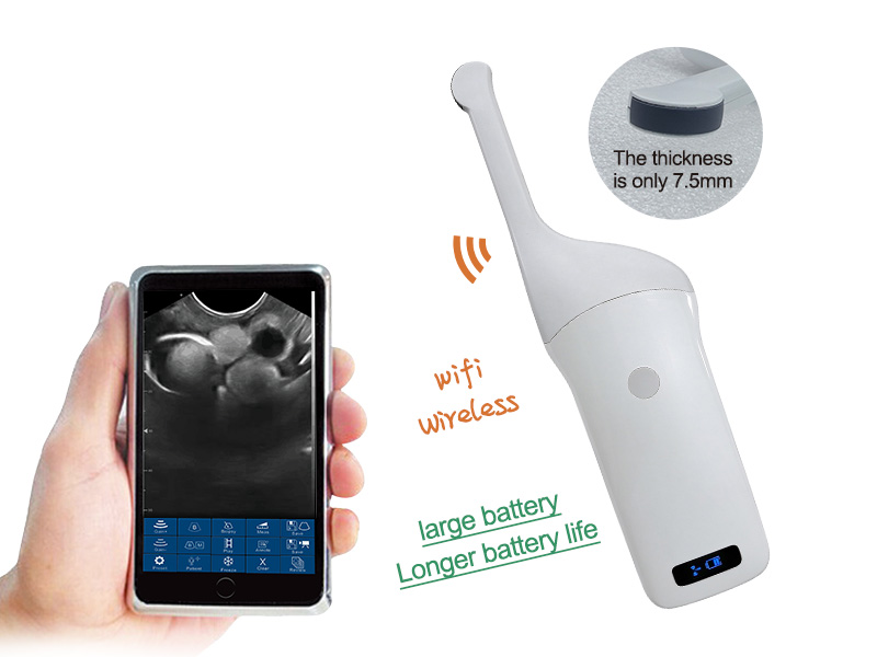 VProbe-5Q Pro Portable Ultrasound for Pregnancy Detection